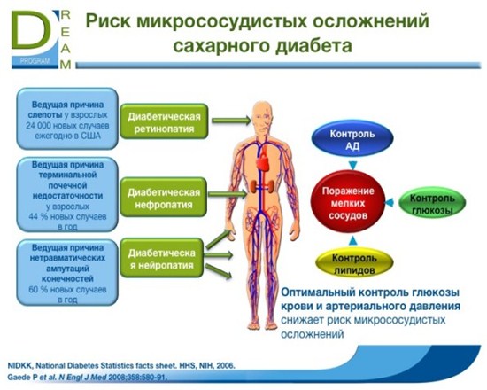 з управління ризиками