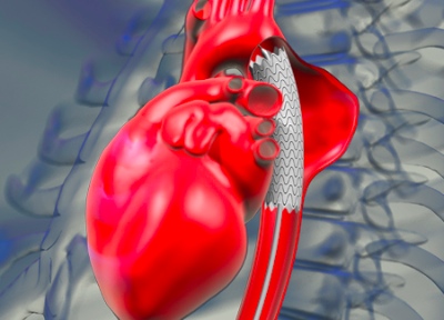 Данный документ заполняет пробел между многочисленными рекомендациями ЕОК по ведению различных патологий сердца и рекомендациями по заболеваниям периферических артерий, опубликованных в 2011 году...